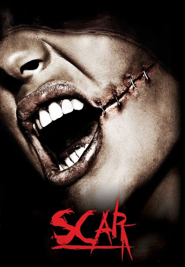 Scar